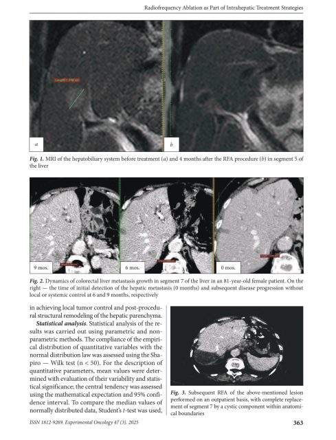 exp-oncology.2025.03.361-images-2