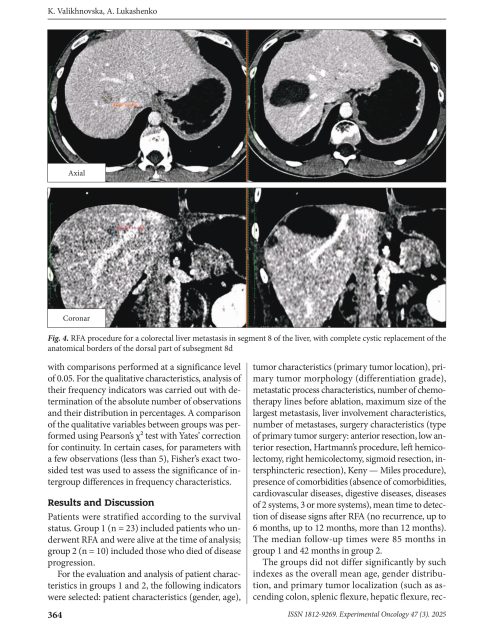 exp-oncology.2025.03.361-images-3